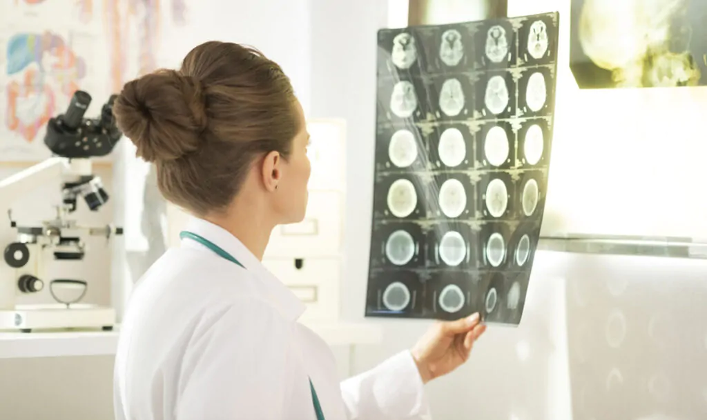 Por que e Quando Procurar um Neurologista